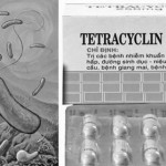 Kháng sinh tetracycline và những lưu ý về tác dụng phụ
